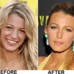 Successful Plastic Surgery Transformations