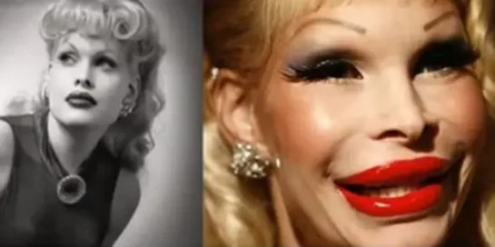 Celebrity Plastic Surgery Transformations