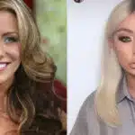 Celebrity Plastic Surgery Transformations