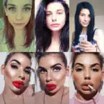 Celebrity Plastic Surgery Transformations