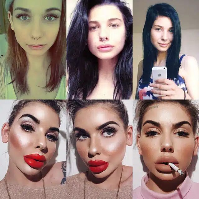 Celebrity Plastic Surgery Transformations