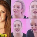 Celebrity Plastic Surgery Transformations