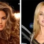 Celebrity Plastic Surgery Transformations