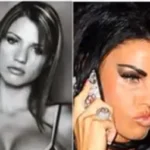 Celebrity Plastic Surgery Transformations