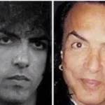 Celebrity Plastic Surgery Transformations