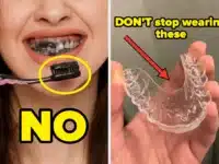 Dentists Are Revealing The Biggest Mistakes People Make With Their Dental Hygiene, And You're Probably Guilty Of These