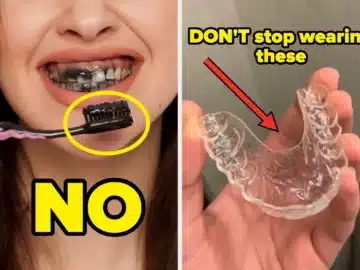 Dentists Are Revealing The Biggest Mistakes People Make With Their Dental Hygiene, And You're Probably Guilty Of These