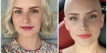 Bald And Bold Women Rocking Their Own Buzz Cuts