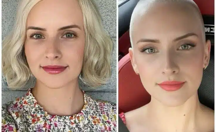 Bald And Bold Women Rocking Their Own Buzz Cuts