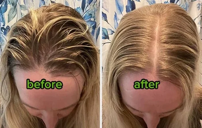 Just 26 Highly Effective Hair Products With Incredible Before And After Photos