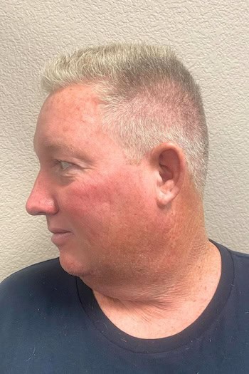 Short Silver Buzz Cut Men's Haircut, side view.