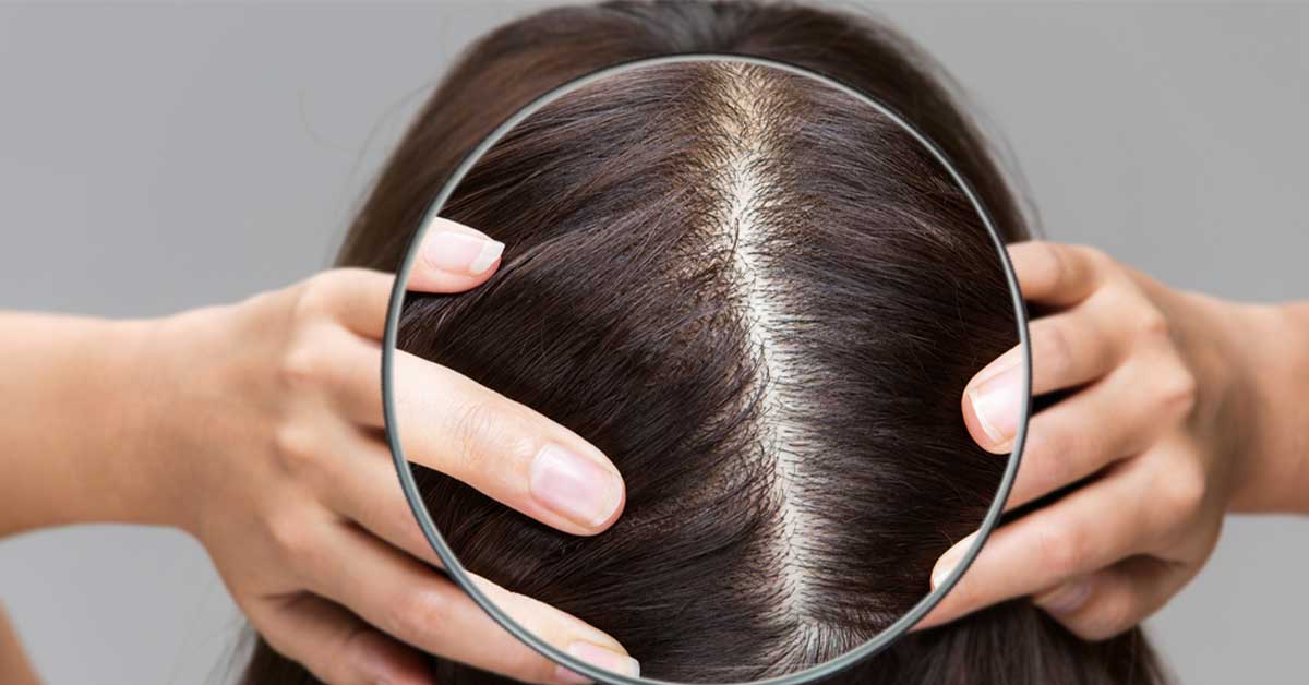 Anatomy of the Scalp