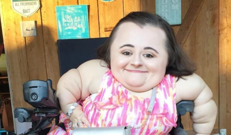 Beauty Influencer with Brittle Bone Disease Goes Viral for Redefining Strength and Style