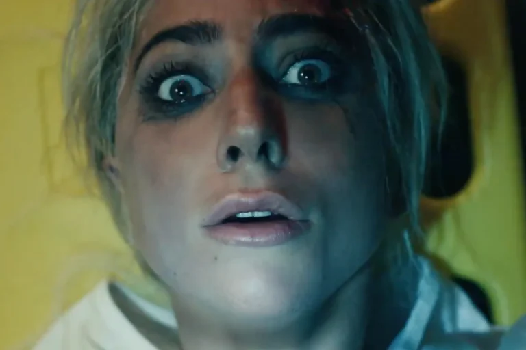 Lady Gaga shares rare photos after…